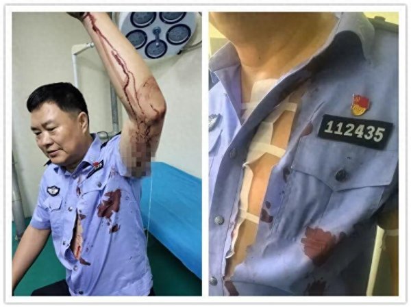 盛金缘证券 内蒙古一男子在小区内持刀行凶! 两名警察被刺伤